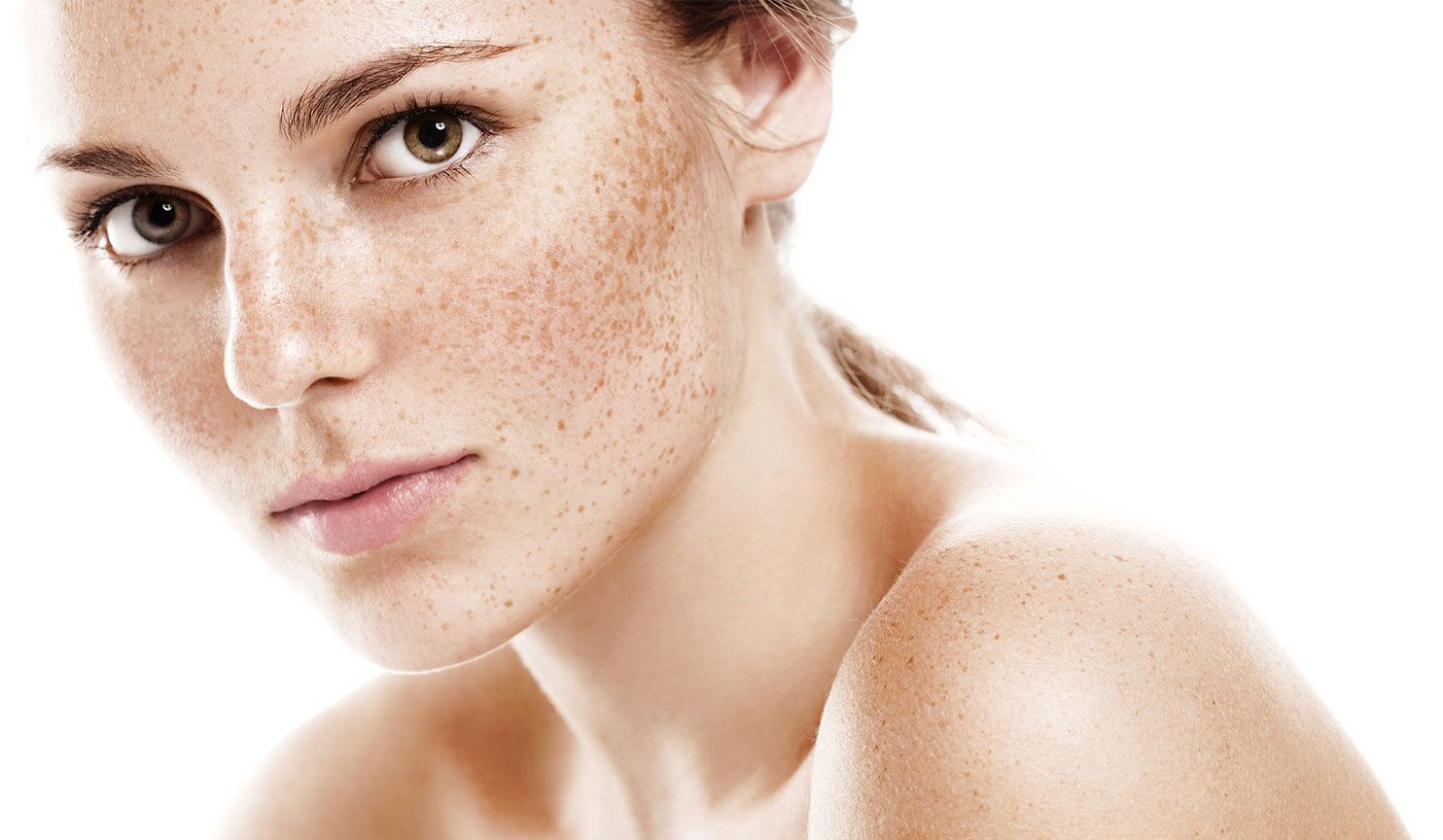 Taches cutanées : pourquoi elles apparaissent et comment éliminer cette ...