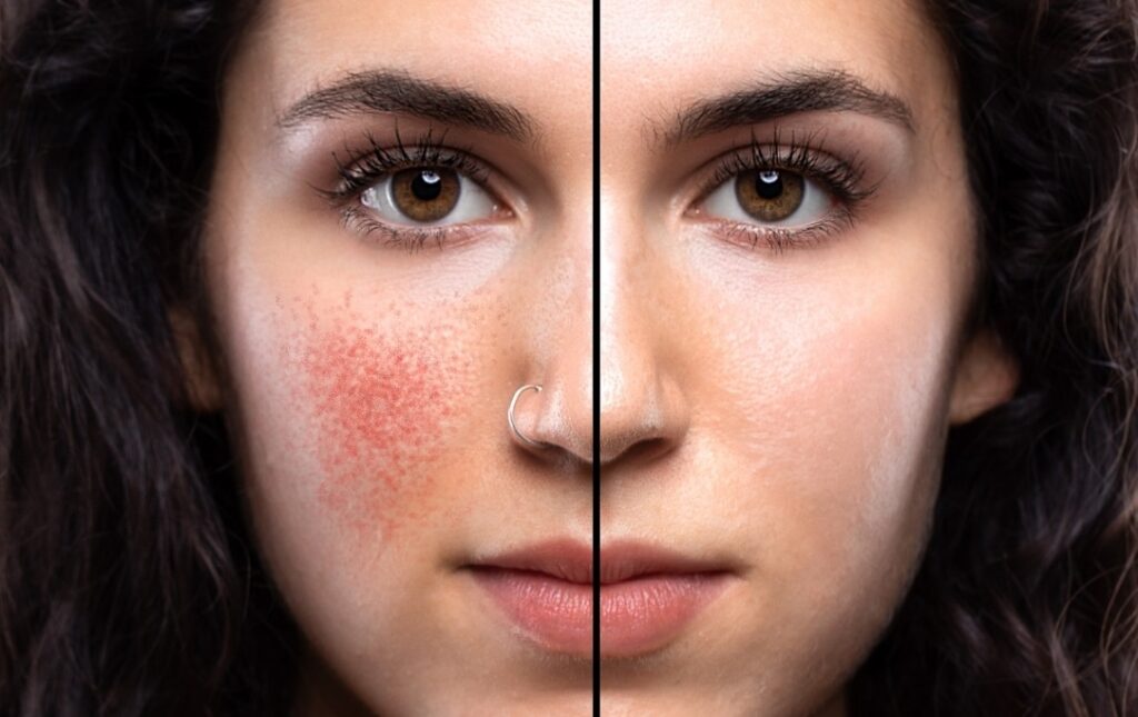 Classification des taches lumineuses
